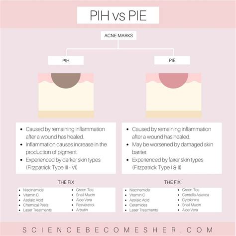 Post Inflammatory Erythema 12 Effective Treatment Options Science