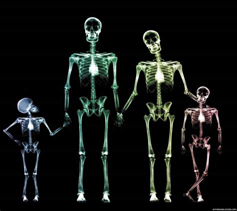 See more ideas about xray art, x ray, radiology. Incredible Human X-Ray Pictures - Photoshop / Graphics 626