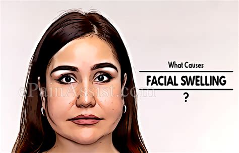 What Causes Facial Swelling