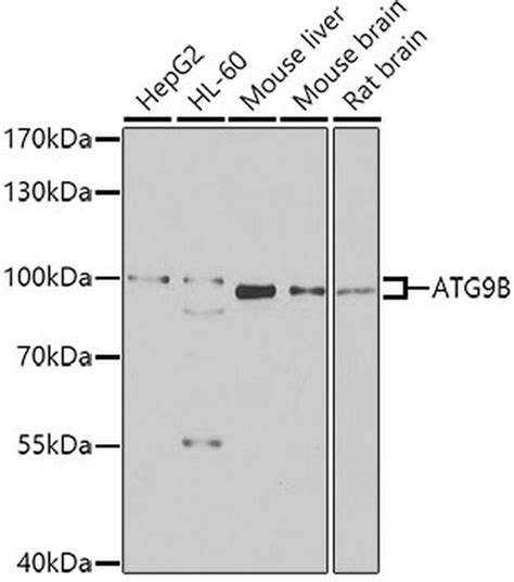 Atg9b Polyclonal Antibody Pa5 96667