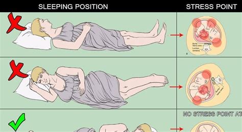 Sleeping Position During Pregnancy With Pictures El Paso Back Clinic®