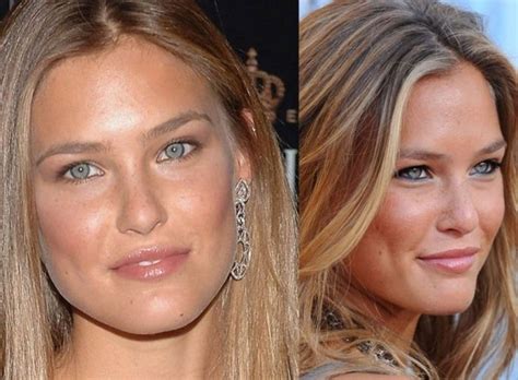 Celebrity Nose Jobs Gone Wrong Celebrity Nose Job Gone Wrong 25 Famous Nose Jobs Before And