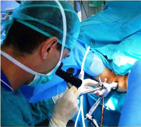 Transanal Endoscopic Microsurgery Tem For Rectal Neoplasms
