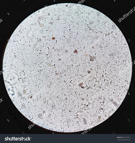 Cyst Of Giardia Under Microscope Micropedia