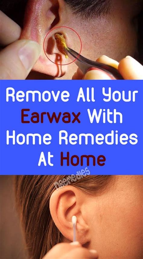 Remove All Your Earwax With Home Remedies At Home Ear Wax Ear Wax