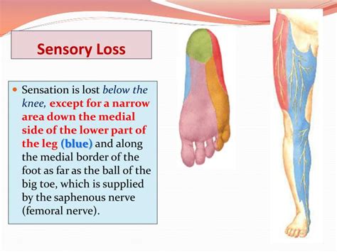 The sciatic nerve is a large nerve that originates from the distal spinal cord and extends along nearly the entire length of the hind limb. PPT - * SCIATIC NERVE PowerPoint Presentation - ID:2103698
