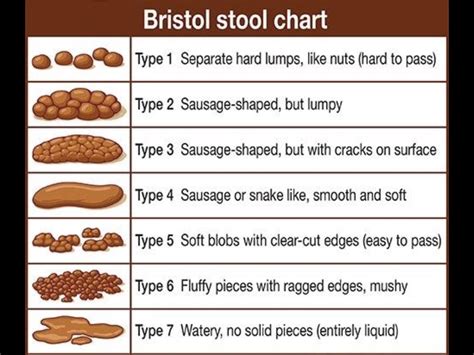 Bowel Bristol Chart Bristol Stool Form Scale Poster By Galina Imrie