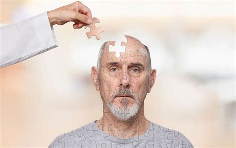 Choroba Alzheimera Objawy Przyczyny Leczenie