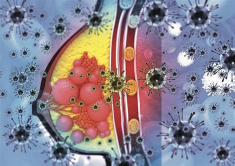 Factors Associated With Lymph Node Involvement In T1 Ct1n0 Her2