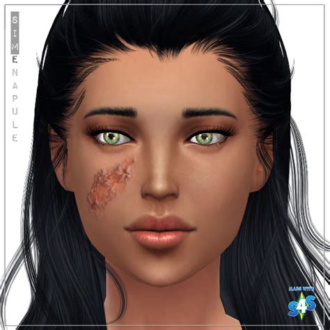 Cc Request Facial Burn Scar For Child To Elder Sims 4
