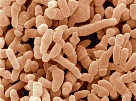 Propionibacterium Acnes Bacteria Sem Stock Image C0282582
