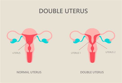 Double Uterus Symptoms Causes Diagnosis And Treatments