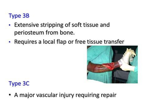 Classification Of Fractures And Compound Fracture Managment
