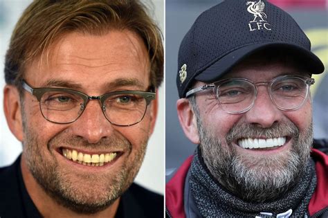 The first set begins to develop when the human baby is three or six months old. Klopp's Teeth vs Firmino's Teeth - Eye-Catching EPL Rivalry