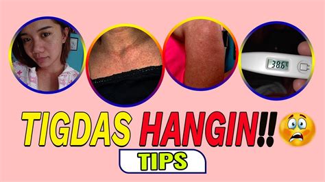 Tigdas Hangin Measles Tips Tagalog Youtube