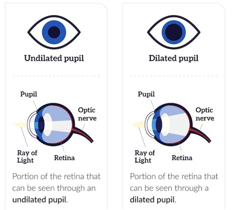Dilated Eye Exam Texas Retina Associates