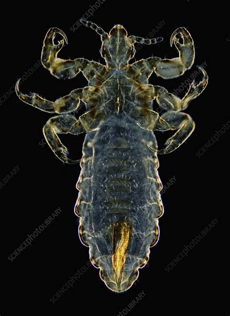 Head Louse Darkfield Lm Stock Image C0057461 Science Photo Library