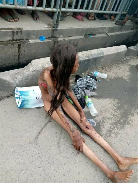 Update SHOCKING Naked Lagos Girl Shrunken To Bones Shows Up In