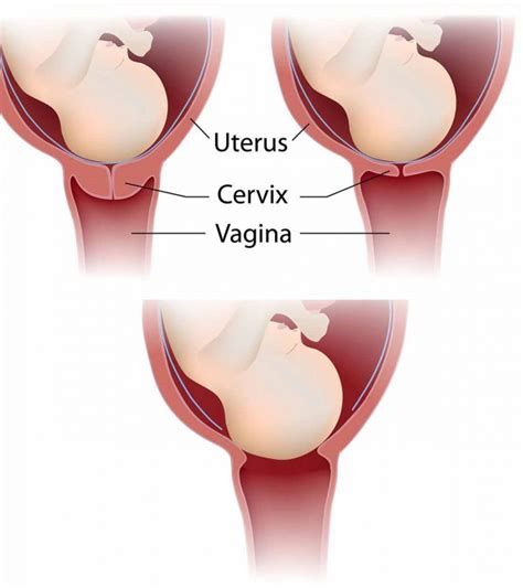 Anatomy Diagram Cervix During Pregnancy