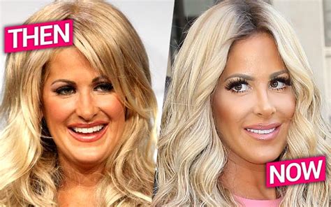 Kim Zolciaks Plastic Surgery Secrets Revealed A Nose Job Fillers And More