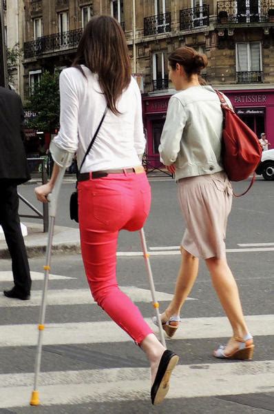 Amputees Woman In Society At Work Crutches Or Prostheses