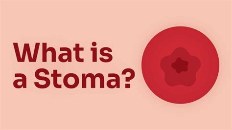 What Is A Stoma Ausmed Lectures
