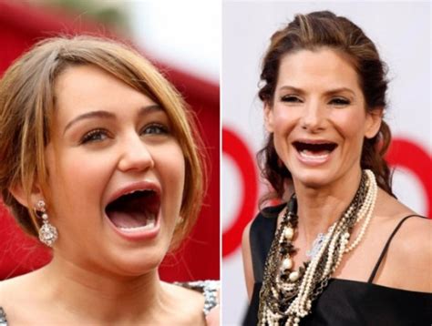 25 Celebrities Without Teeth Funcage