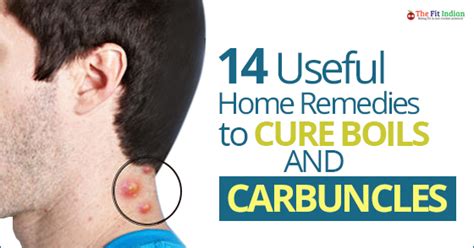 14 Powerful Natural Remedies For Painful Boils And Carbuncles