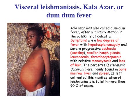 Pdf Visceral Leishmaniasis Kala Azar Or Dum Dum Fever