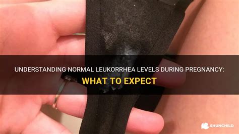 Understanding Normal Leukorrhea Levels During Pregnancy What To Expect