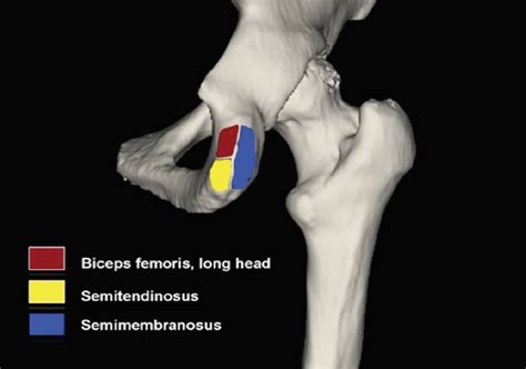 Hamstring Muscles Origin And Insertion