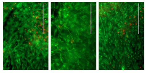 Burns Treatment Virtual Reality Fashion And Growing New Human Tissue