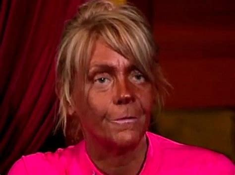 Tan Mom No More Patricia Krentcil Gives Up Tanning For Botox Boca