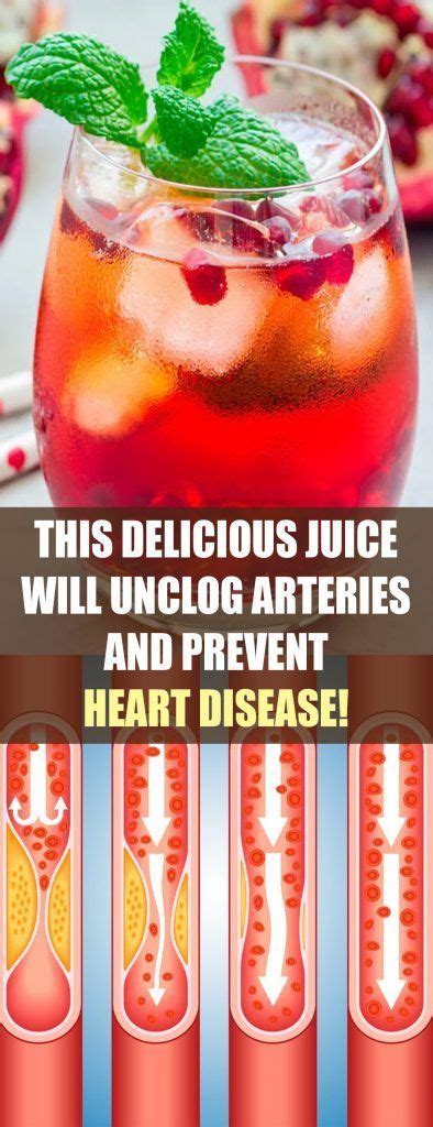 Juicing extracts the juice from fresh fruits or vegetables. Arteries Remedies This Delicious Juice Will Unclog ...