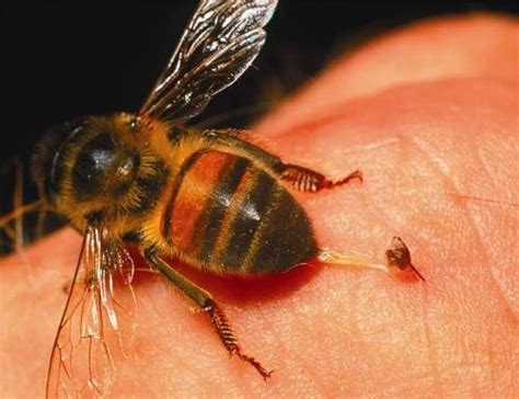 Padahal, banyak cara memutihkan kulit secara alami, lo. Biar Betul? Racun Lebah Buatkan Kulit Kelihatan Lebih Muda ...