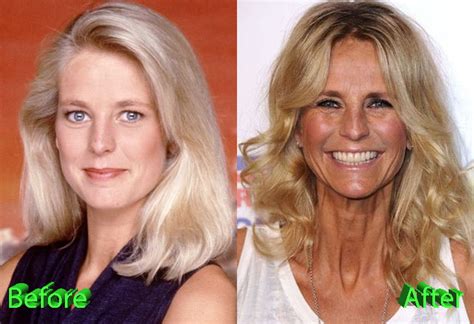 The tv star, 53, said her heart was incandescent with envy when she read a recent story about a grandmother in a relationship with. Ulrika Jonsson Plastic Surgery -Did It Improve Or Degrade ...