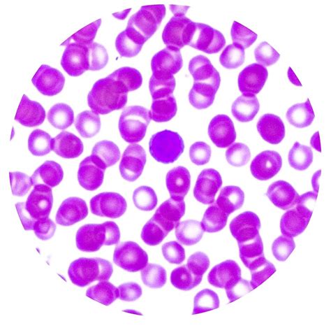 Lymphocyte Histology And Histophathology