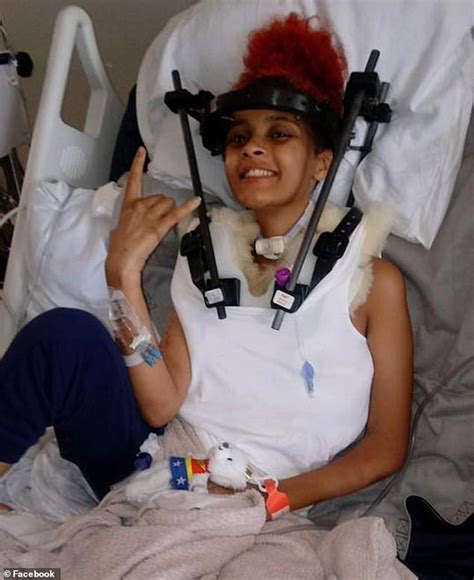 Girl 17 Left Paralyzed In Crash When Her Skull Detached From Her Spine Defies Odds To Walk