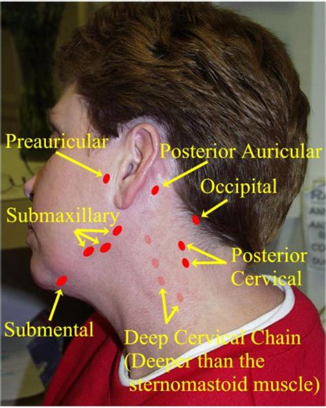 The physician will need to check the nodes that are close to the surface for tenderness, size, texture as well as warmth. Examining the Neck