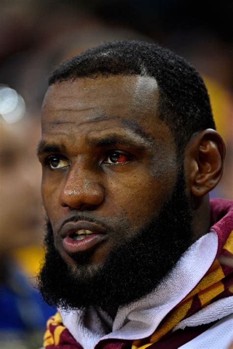 LeBron James' eye is still freaky, and fans can't stop talking about it