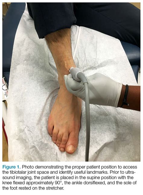 Emergency Ultrasound Ultrasound Guided Arthrocentesis Of The Ankle