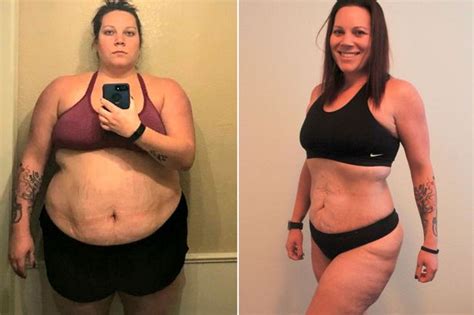 Womans Weight Loss Transformation After Shedding 11st Without Stepping