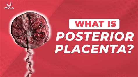 What Is Posterior Placenta Meaning In Hindi What Does Low Lying