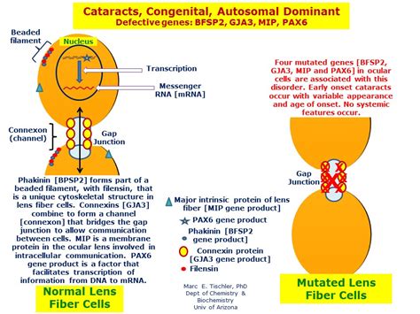 Cataracts Congenital Autosomal Dominant Hereditary Ocular Diseases