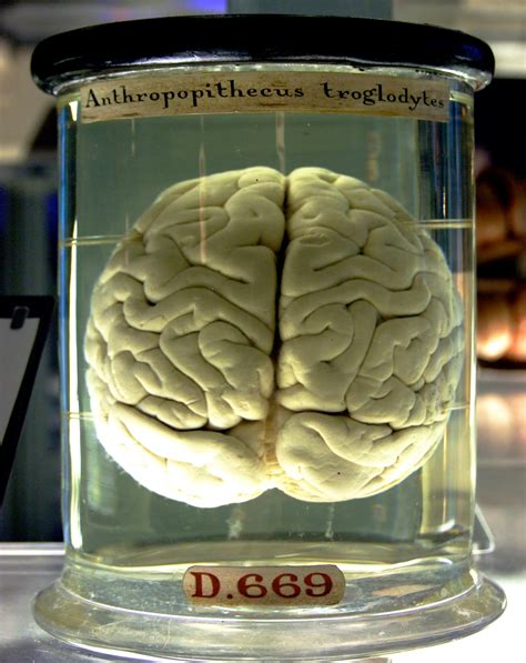 Filechimp Brain In A Jar Wikipedia The Free Encyclopedia
