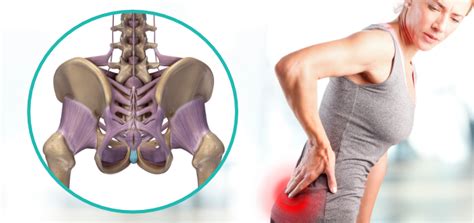 Lower Back Pain In Women Sequence Wiz