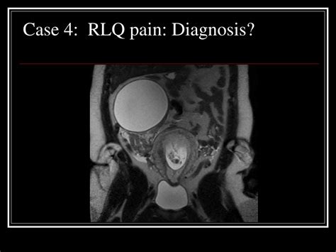 Ppt Introduction To Radiology Powerpoint Presentation