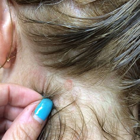 Pin On Scalp Rejuvenation By Hairholistic