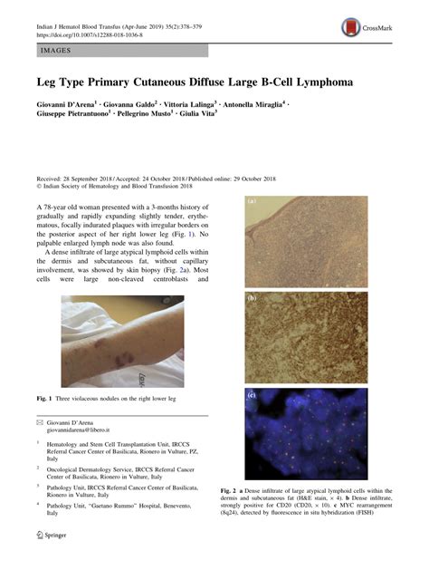 Pdf Leg Type Primary Cutaneous Diffuse Large B Cell Lymphoma
