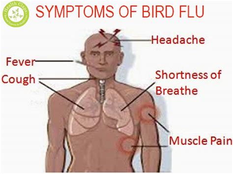 Use the information below to learn about the symptoms of avian flu for birds and h. Avian Flu outbreak in Uganda is bad news for travel ...